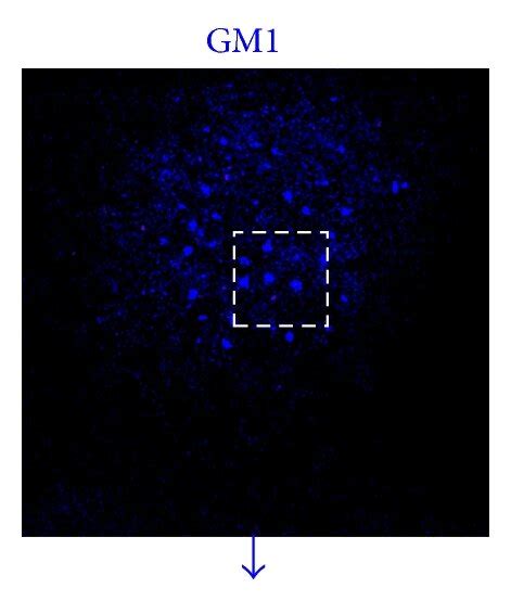 NSOM QD Based Dual Color Imaging Of CD3 And GM1 For T Cells