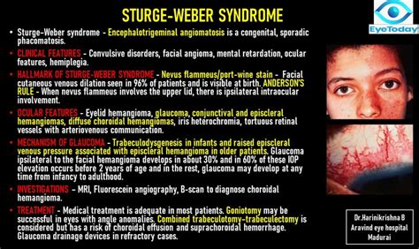 Sturge-Weber Syndrome - EyeToday