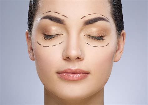 Blefaroplastia Clínica IDEAL Dermatologia estética