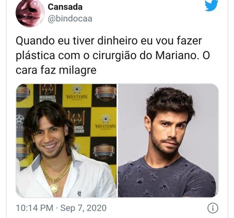 Antes E Depois Do Cantor Mariano Viraliza Nas Redes Sociais