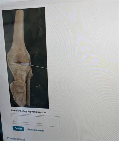 L Cadaver Appendicular Skeleton Joints Lab Chegg