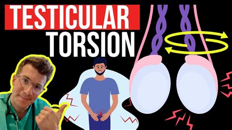 Doctor Explains Testicular Torsion Twisting Of The Testicle