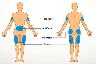 Insulina O Que Tipos Para Que Serve E Como Aplicar Tua Sa De