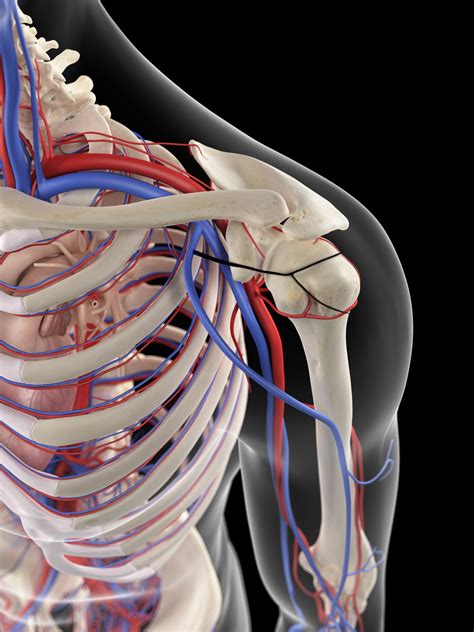 Thoracic Outlet Syndrome: Diagnosis, Clinical Management