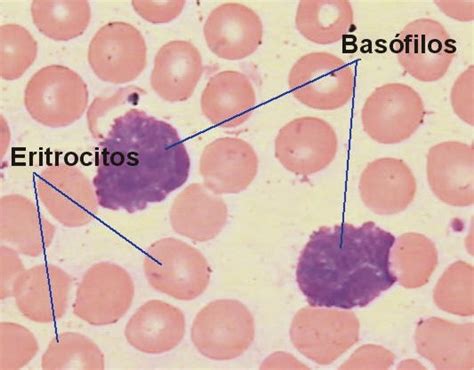 Fichero De Hematolog A Heber May N