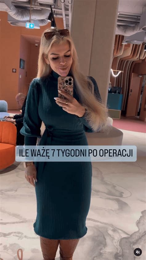 Ile ważę 7 tygodni po operacji Kasia Guzik