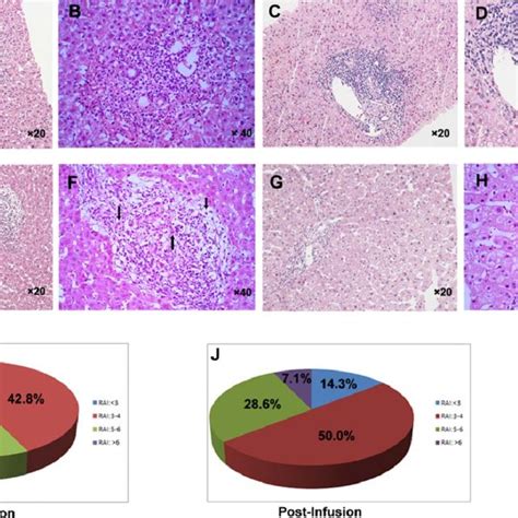 Uc Mscs Alleviate Liver Damage In Liver Allograft Recipients With Acute