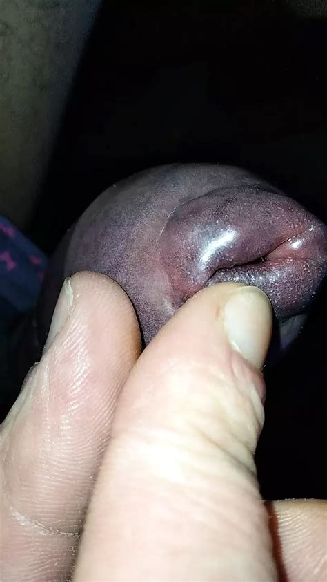Swollen Helmet Phimosis Nipple Close Up Gay BDSM Porn XHamster