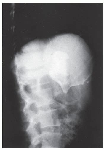 C23-FF51.gif | Abdominal Key 