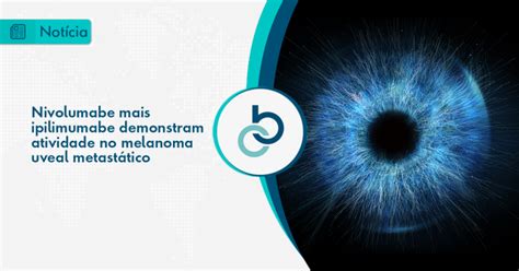 Nivolumabe Mais Ipilimumabe Demonstram Atividade No Melanoma Uveal