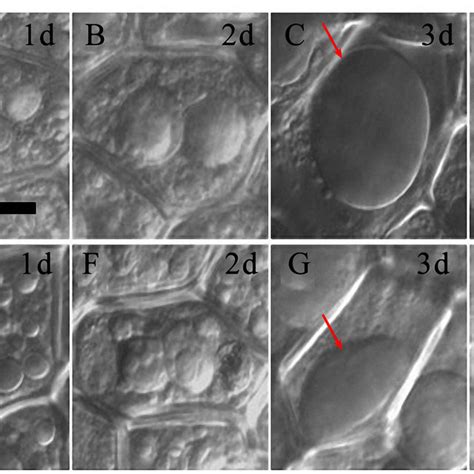 The Vacuolated Process Of Aleurone Cells Treated With Distilled