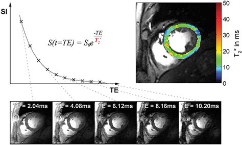 Frontiers Myocardial T2 Mapping With Ultrahigh Field Magnetic