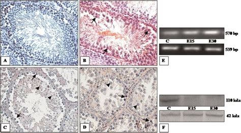 Immunolocalization Of Androgen Receptor Ar In Representative Testis