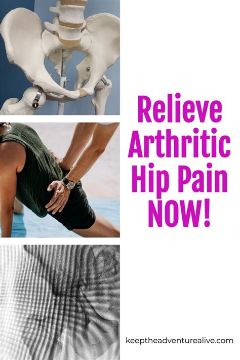 5 exercises to relieve hip arthritis pain – Artofit