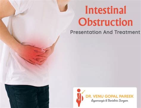 Intestinal obstruction surgery Archives - Dr. V Pareek