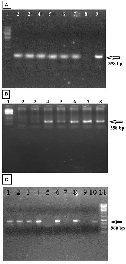 PCR Amplification Of Transgenic Cotton Plants During Three Generations