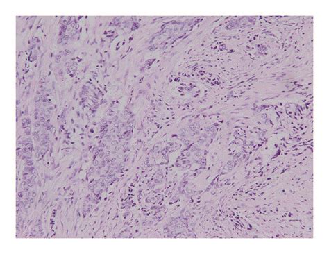 Histopathological Diagnosis Hande Staining Of Samples From The 3