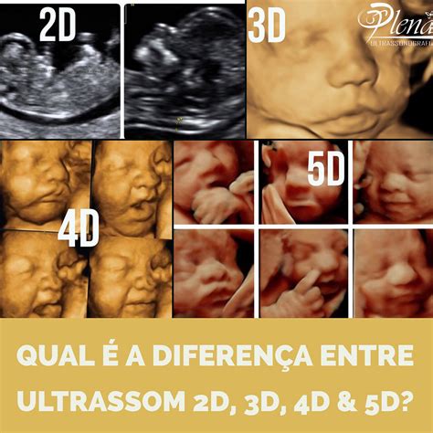 Qual A Diferen A Entre Ultrassom D D D D