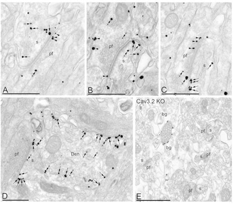 Cellular And Subcellular Localization Of Cav3 2 In The Cb Electron