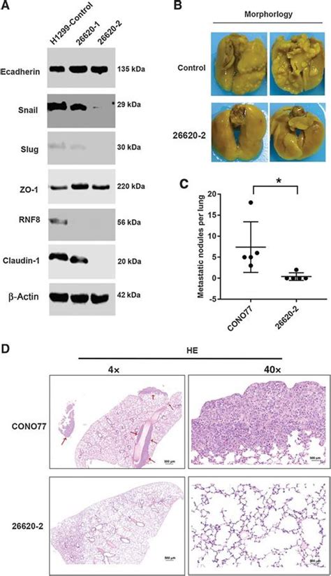 Rnf8 Promotes Epithelialmesenchymal Transition In Lung Cancer Cells