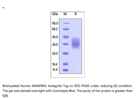 Acrobiosystems Recombinant Protein Biotinylated Human Emmprin Cd