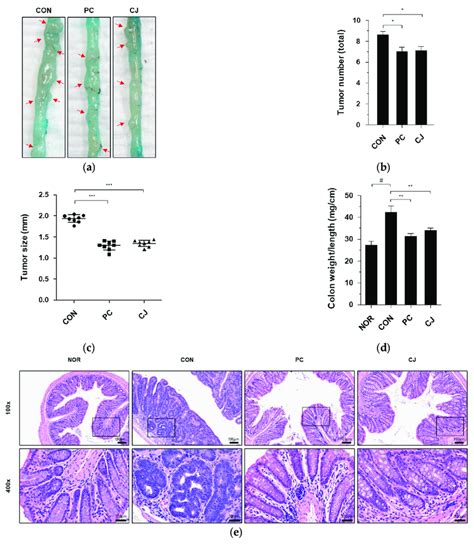 Effects Of CJ On Tumorigenesis In Mice With AOM DSS Induced CAC A