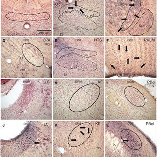 Bright Field Photomicrographs Of Sections Showing Immunolabeling Of