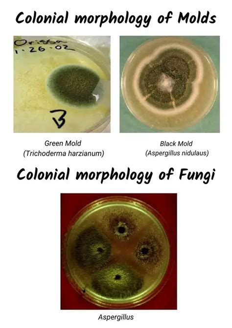 Colony Morphology of Bacteria and Examples - Biology Notes Online