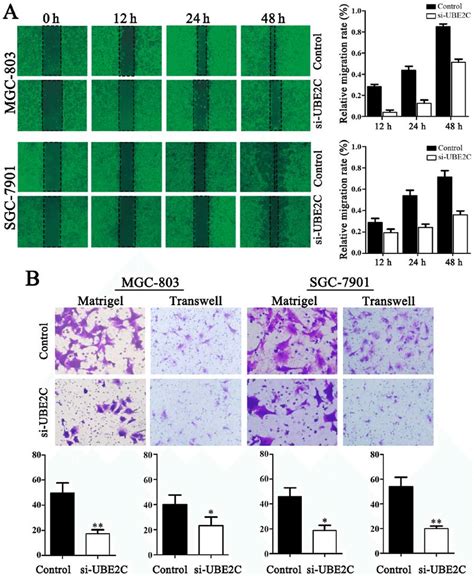 Knockdown Of UBE2C Inhibits The Migration And Invasion Of Gastric