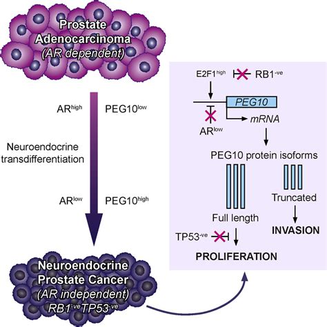 The Placental Gene Peg Promotes Progression Of Neuroendocrine