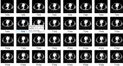 医学图像预处理之可视化如何可视化niigz文件 Csdn博客