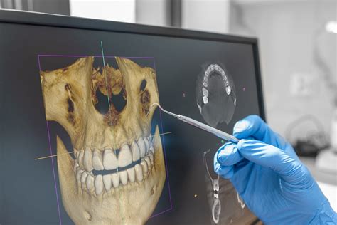 Cone Beam CT - There’s a Code for That - True View Dental Radiology