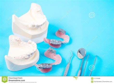 Herramientas Del Dentista Y Modelo Prosthodontic Foto De Archivo