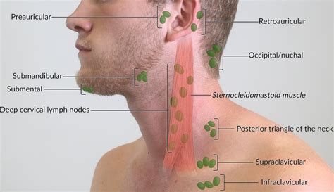 Supraclavicular Lymph Node Swollen From Mold Exposure Securityvery