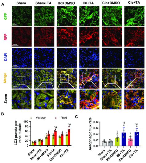 Hdac Inhibition Promoted Autophagic Flux In Autophagy Reporter Mice