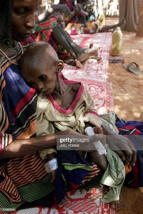 An Ethiopian mother hold her child suffering malnutrition in Gode ...