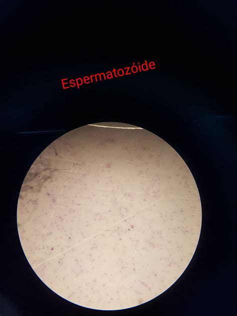 Lamina Espermatozoide Histologia E Embriologia Geral The Best Porn