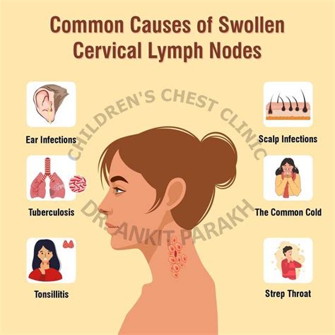 Lymphadenopathy Def Abnormal Enlargement Of Lymph Node Type Of