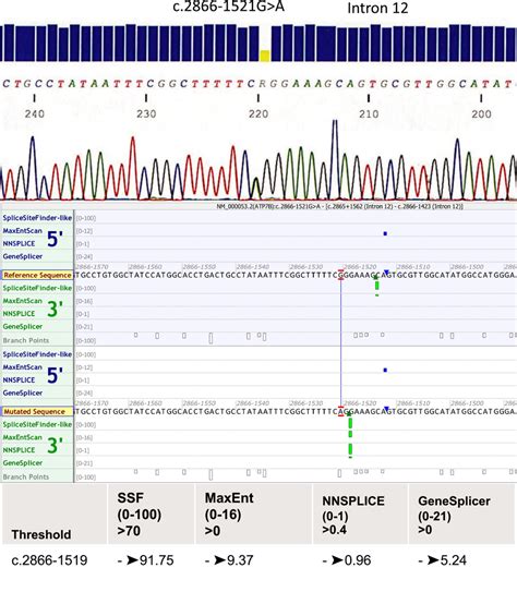 Electropherogram of Sanger sequencing results of the intronic variant ...