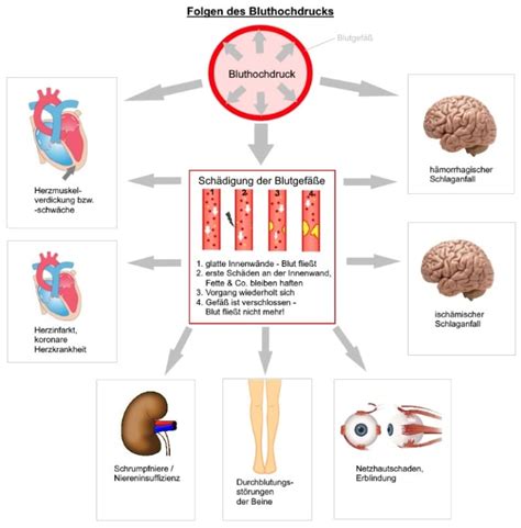 Bluthochdruck Arterielle Hypertonie Was Bedeutet Das F R Mich