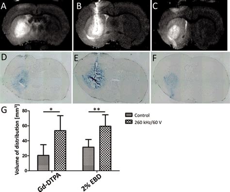 Intraparenchymal Ultrasound Application And Improved Distribution Of