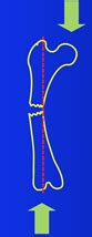 Diaphyseal fracture healing Flashcards | Quizlet
