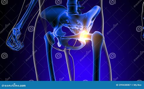 Hip Joint Pain Anatomy for Medical Concept 3D Stock Video - Video of ...