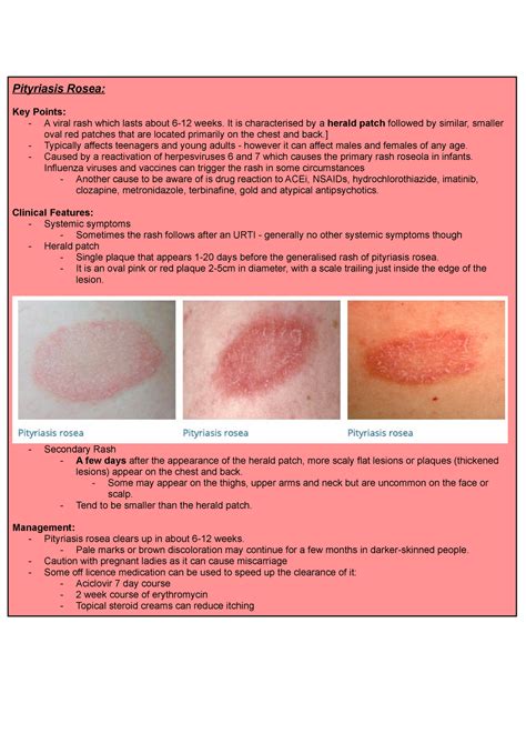 Pityriasis Rosea Herald Patch