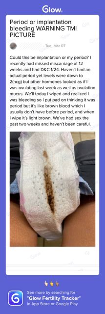 WARNING TMI PICTURE Implantation Bleeding Or Period Glow Community