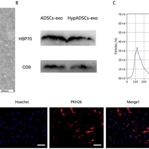 Characterization Of ADSCs Exo A Morphology Observed Under Transmission