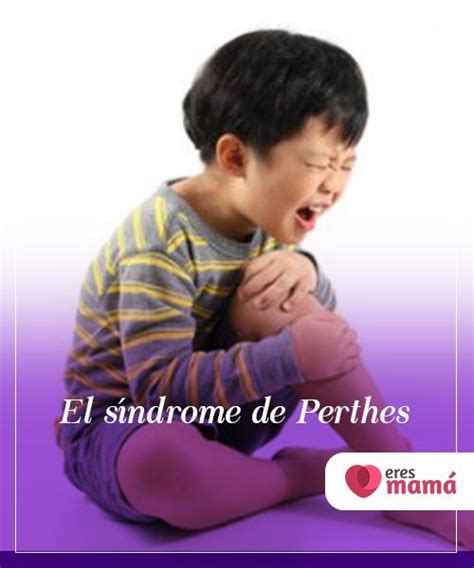 El S Ndrome De Perthes El S Ndrome De Perthes Es Una Patolog A Que