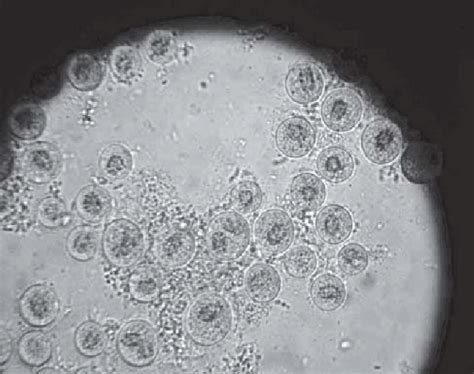 Cystic Forms Of Naegleria Fowleri In Culture 10x Magnification Download Scientific Diagram