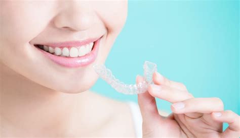 4 Surprising Benefits Of Invisalign 54th Street Dental General Dentists