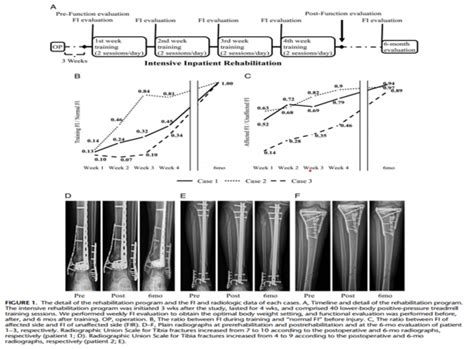 Early Quantitative Partial Weight Bearing Exercise After Periarticular